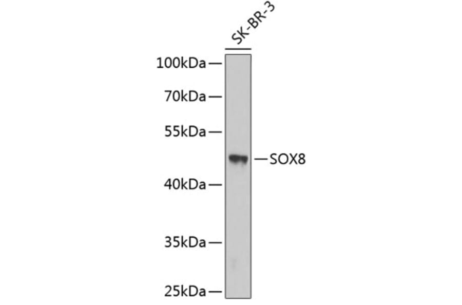 Western Blot - Anti-SOX8 Antibody (A3131) - Antibodies.com
