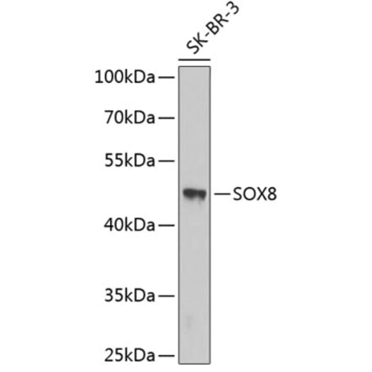 Western Blot - Anti-SOX8 Antibody (A3131) - Antibodies.com