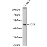 Western Blot - Anti-SOX8 Antibody (A3131) - Antibodies.com