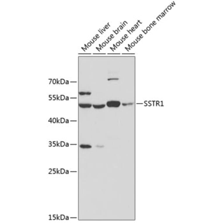 Western Blot - Anti-Somatostatin Receptor 1/SSTR1 Antibody (A14372) - Antibodies.com
