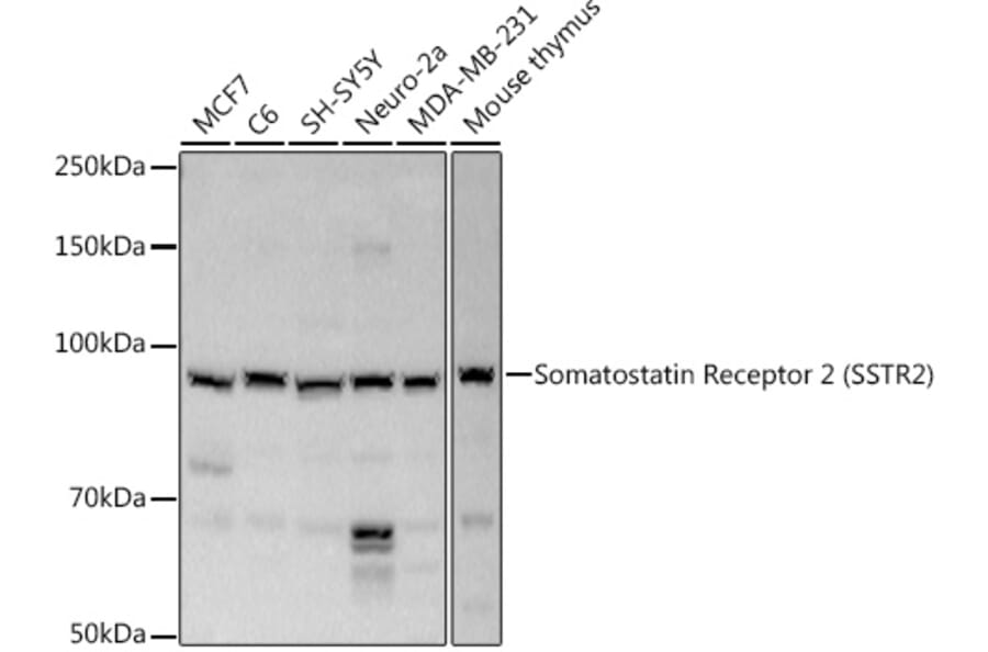 Western Blot - Anti-Somatostatin Receptor 2 Antibody (A14373) - Antibodies.com