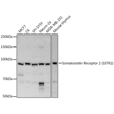 Western Blot - Anti-Somatostatin Receptor 2 Antibody (A14373) - Antibodies.com