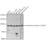 Western Blot - Anti-Somatostatin Receptor 2 Antibody (A14373) - Antibodies.com