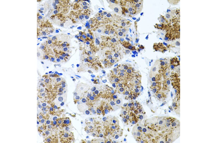 Immunohistochemistry - Anti-Somatostatin Receptor 2 Antibody (A14373) - Antibodies.com