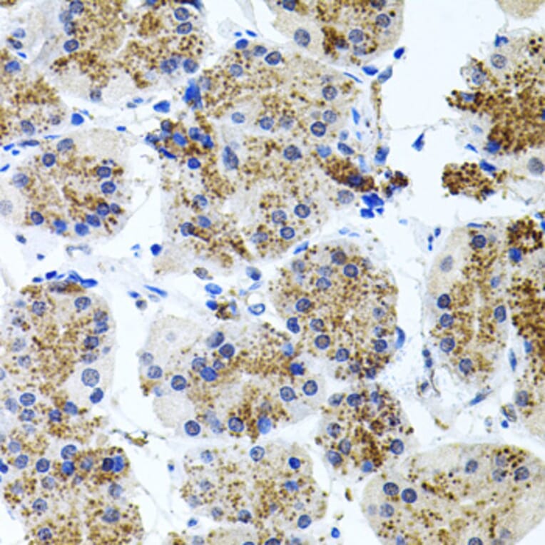 Immunohistochemistry - Anti-Somatostatin Receptor 2 Antibody (A14373) - Antibodies.com
