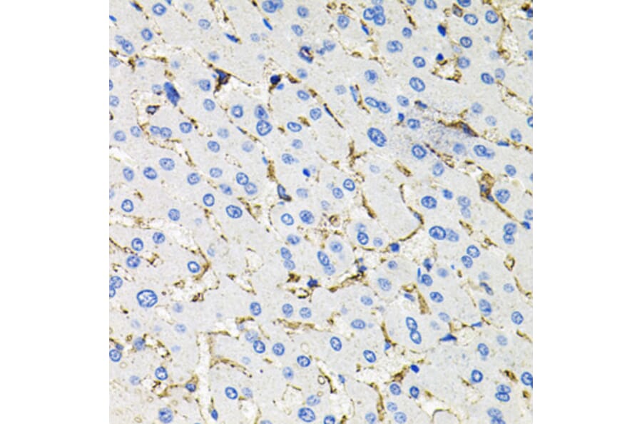 Immunohistochemistry - Anti-Somatostatin Receptor 2 Antibody (A14373) - Antibodies.com