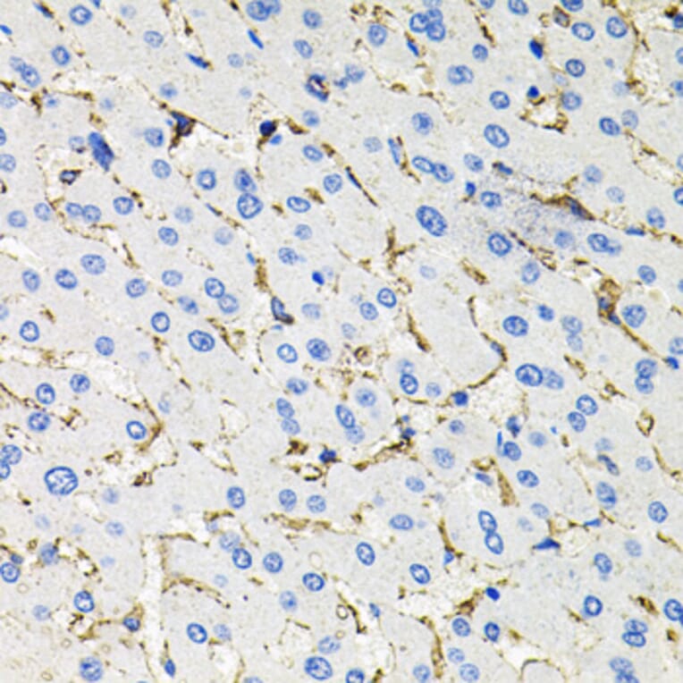 Immunohistochemistry - Anti-Somatostatin Receptor 2 Antibody (A14373) - Antibodies.com