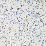 Immunohistochemistry - Anti-Somatostatin Receptor 2 Antibody (A14373) - Antibodies.com