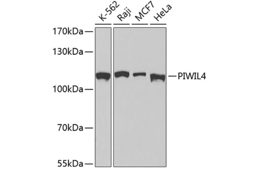 Western Blot - Anti-PIWIL4 Antibody (A3144) - Antibodies.com