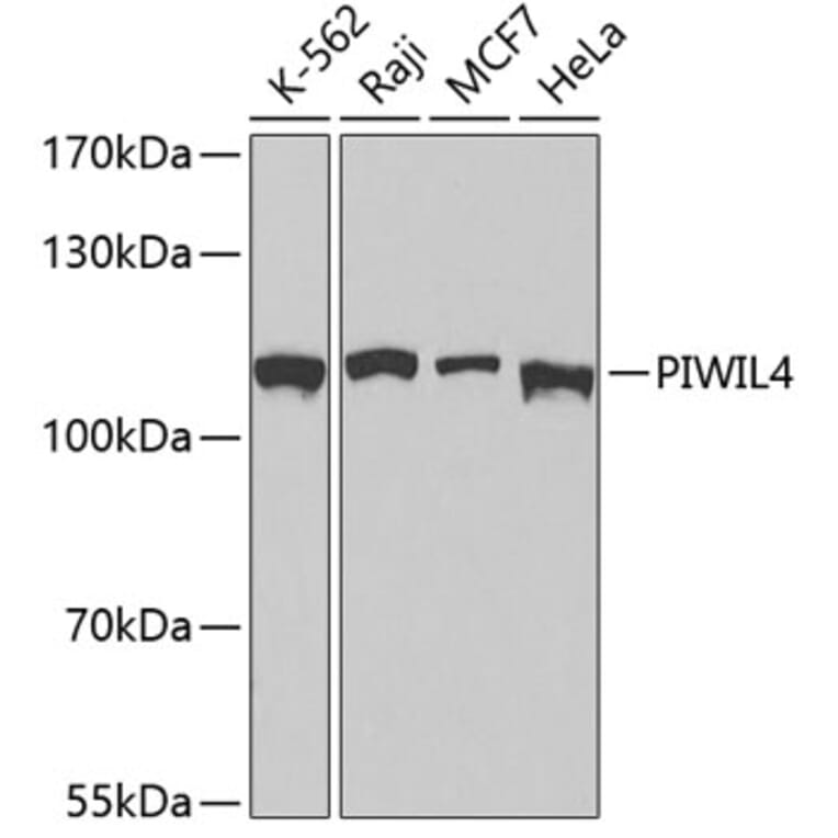 Western Blot - Anti-PIWIL4 Antibody (A3144) - Antibodies.com