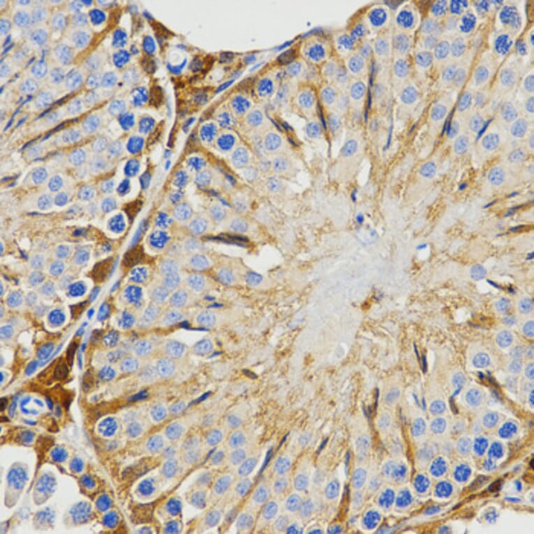 Immunohistochemistry - Anti-PIWIL4 Antibody (A3144) - Antibodies.com