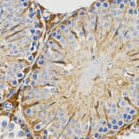 Immunohistochemistry - Anti-PIWIL4 Antibody (A3144) - Antibodies.com