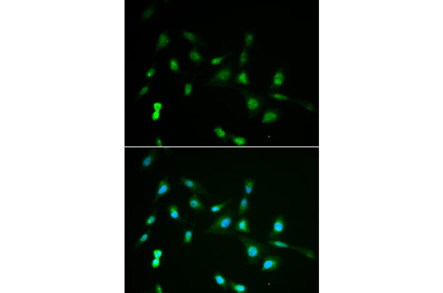 Immunofluorescence - Anti-PIWIL4 Antibody (A3144) - Antibodies.com