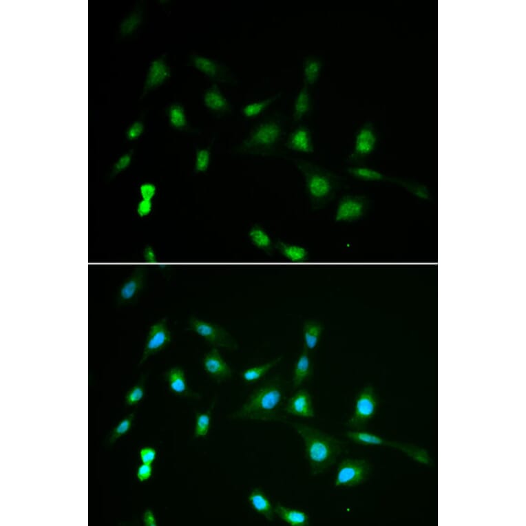 Immunofluorescence - Anti-PIWIL4 Antibody (A3144) - Antibodies.com