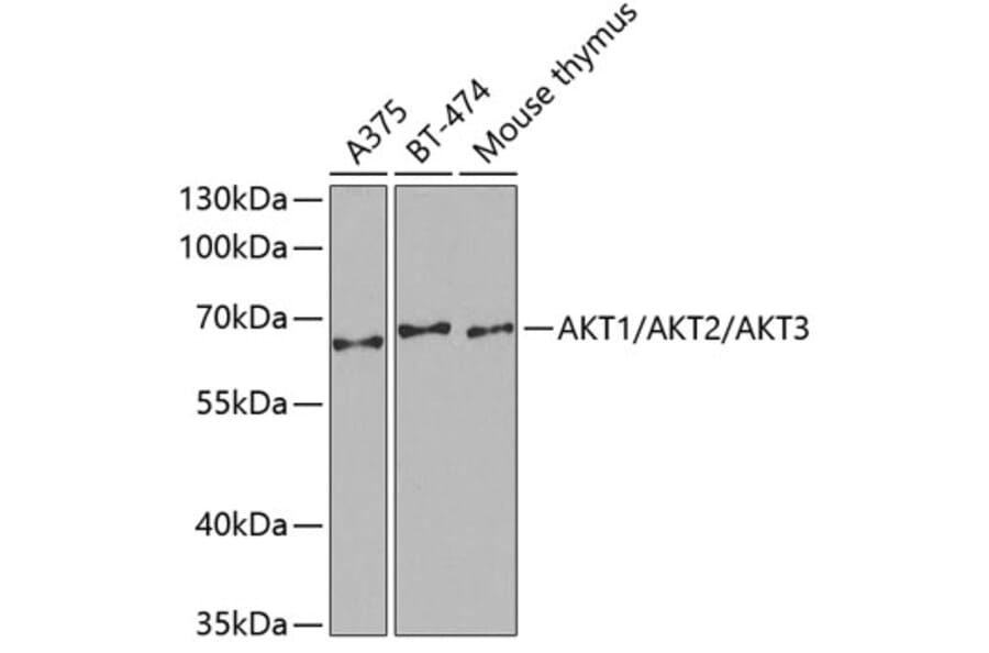 Western Blot - Anti-Pan-AKT Antibody (A3145) - Antibodies.com