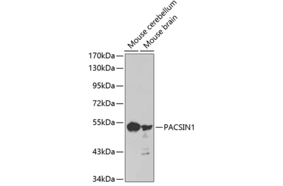 Western Blot - Anti-PACSIN1 Antibody (A3146) - Antibodies.com