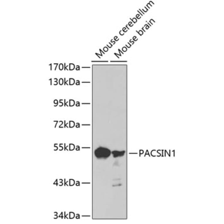 Western Blot - Anti-PACSIN1 Antibody (A3146) - Antibodies.com