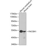 Western Blot - Anti-PACSIN1 Antibody (A3146) - Antibodies.com