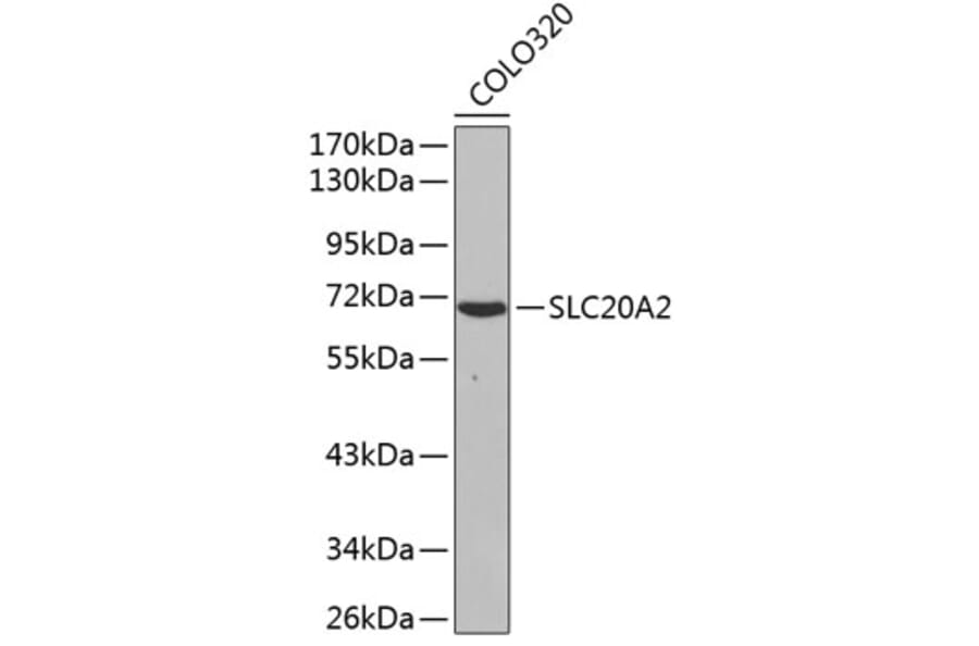 Western Blot - Anti-SLC20A2 Antibody (A3148) - Antibodies.com