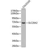 Western Blot - Anti-SLC20A2 Antibody (A3148) - Antibodies.com