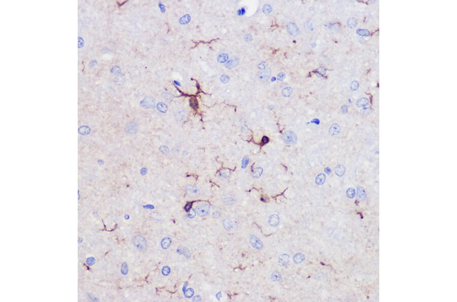 Immunohistochemistry - Anti-Iba1 Antibody (A14379) - Antibodies.com