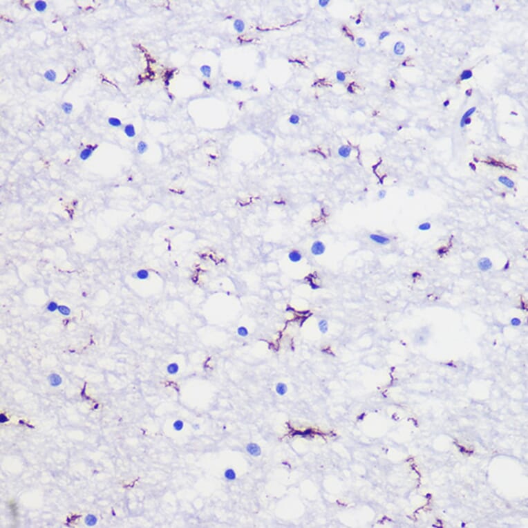 Immunohistochemistry - Anti-Iba1 Antibody (A14379) - Antibodies.com