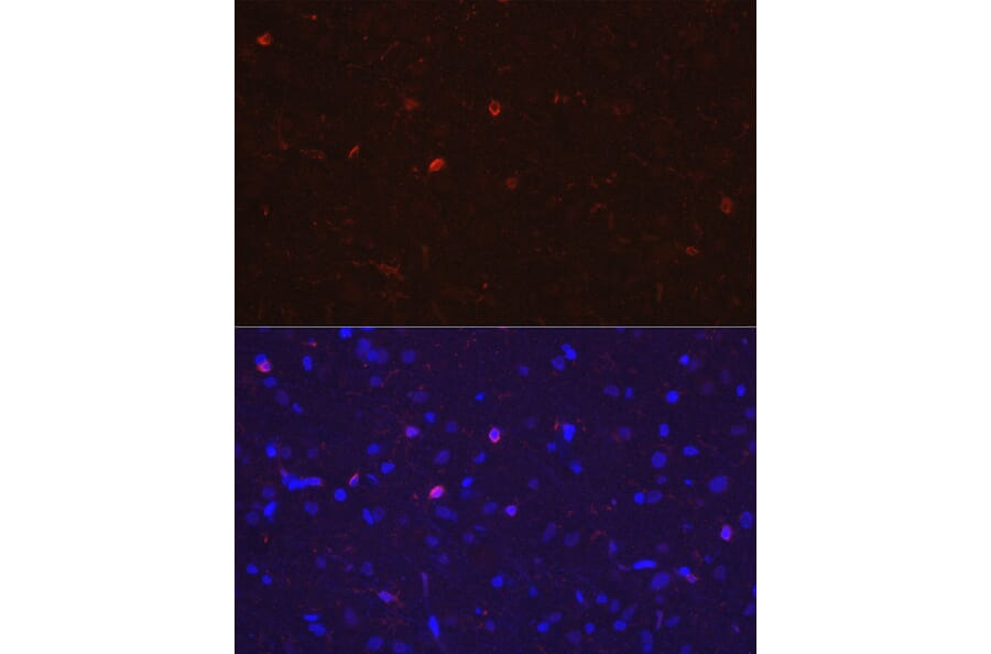 Immunofluorescence - Anti-Iba1 Antibody (A14379) - Antibodies.com
