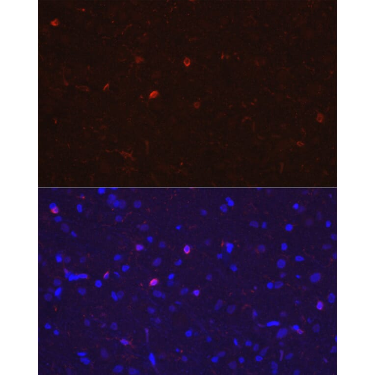 Immunofluorescence - Anti-Iba1 Antibody (A14379) - Antibodies.com