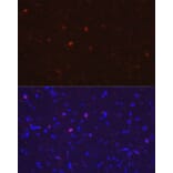 Immunofluorescence - Anti-Iba1 Antibody (A14379) - Antibodies.com