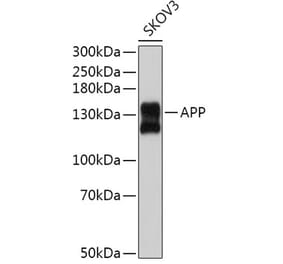 Western Blot - Anti-Amyloid Precursor Protein Antibody (A14380) - Antibodies.com