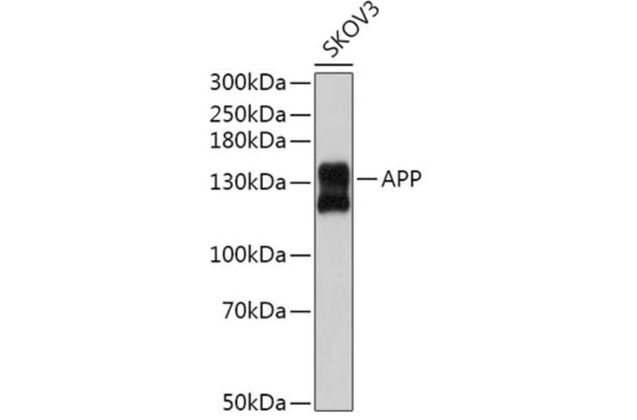 Western Blot - Anti-Amyloid Precursor Protein Antibody (A14380) - Antibodies.com