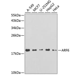 Western Blot - Anti-ARF6 Antibody (A14381) - Antibodies.com