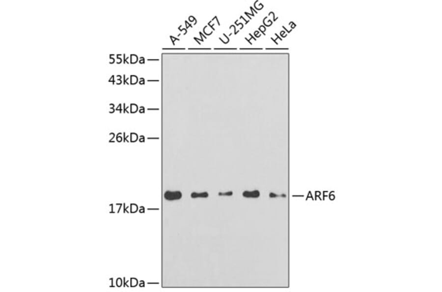Western Blot - Anti-ARF6 Antibody (A14381) - Antibodies.com