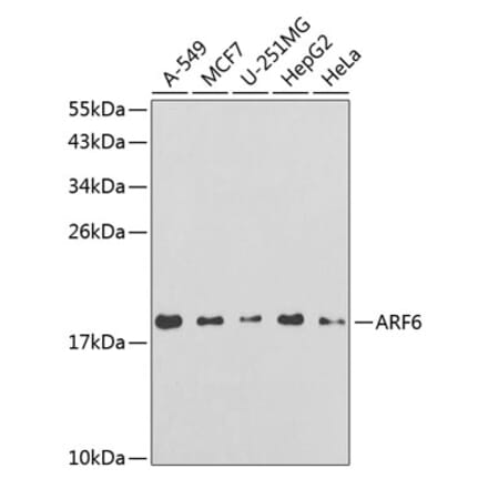 Western Blot - Anti-ARF6 Antibody (A14381) - Antibodies.com