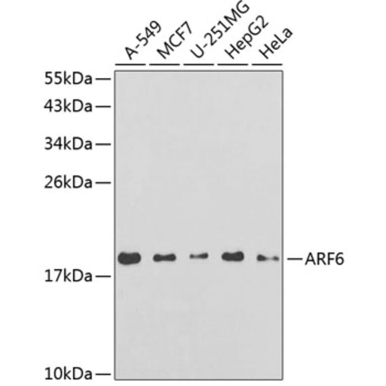Western Blot - Anti-ARF6 Antibody (A14381) - Antibodies.com