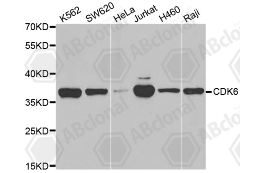 Western Blot - Anti-CDK6 Antibody (A3165) - Antibodies.com