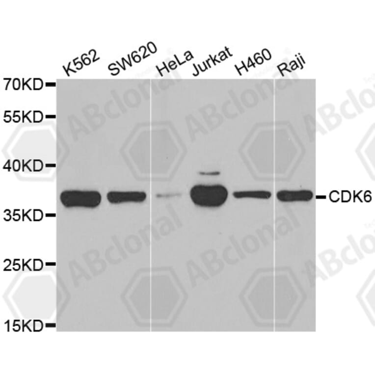 Western Blot - Anti-CDK6 Antibody (A3165) - Antibodies.com