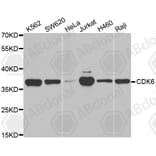 Western Blot - Anti-CDK6 Antibody (A3165) - Antibodies.com