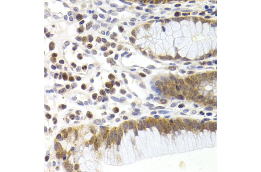 Immunohistochemistry - Anti-CDK6 Antibody (A3165) - Antibodies.com