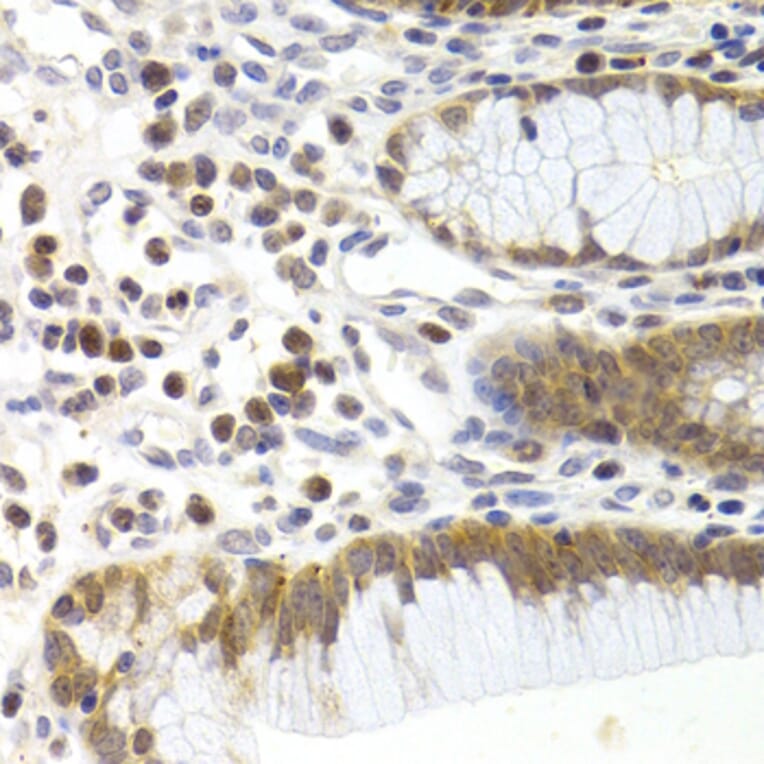Immunohistochemistry - Anti-CDK6 Antibody (A3165) - Antibodies.com