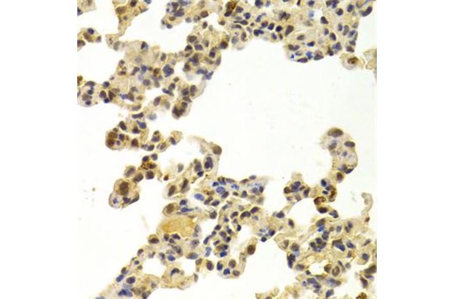 Immunohistochemistry - Anti-CDK6 Antibody (A3165) - Antibodies.com