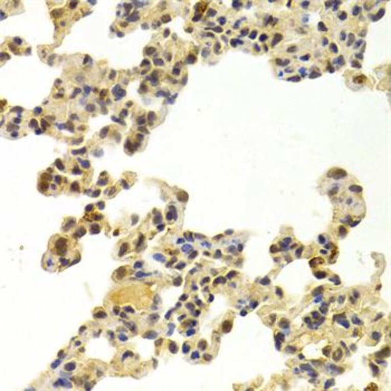 Immunohistochemistry - Anti-CDK6 Antibody (A3165) - Antibodies.com
