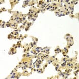 Immunohistochemistry - Anti-CDK6 Antibody (A3165) - Antibodies.com