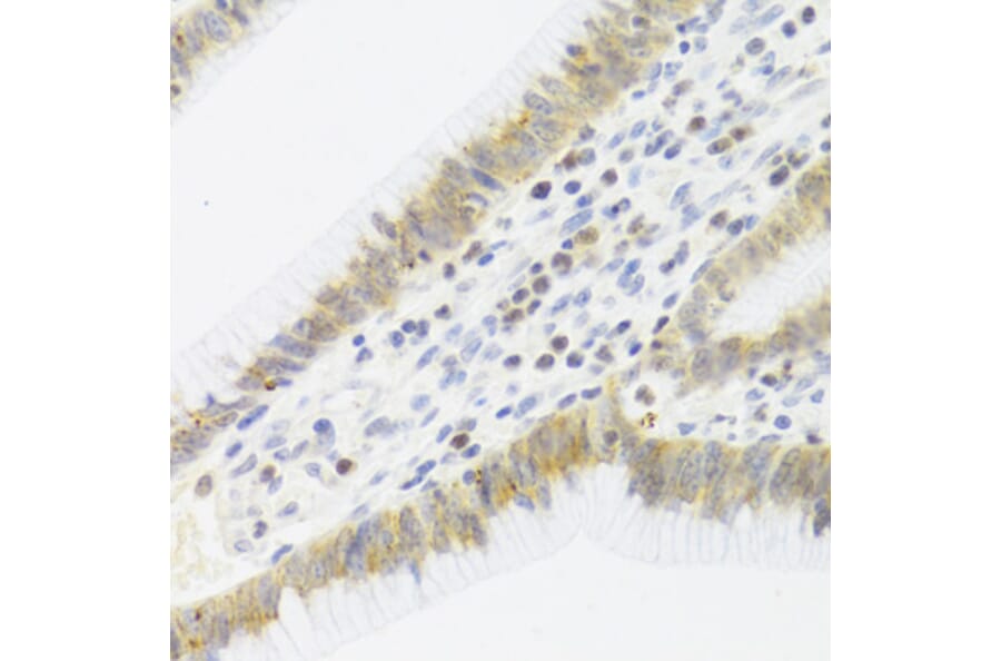 Immunohistochemistry - Anti-CDK6 Antibody (A3165) - Antibodies.com