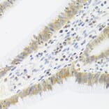 Immunohistochemistry - Anti-CDK6 Antibody (A3165) - Antibodies.com