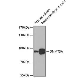 Western Blot - Anti-Dnmt3a Antibody (A14385) - Antibodies.com