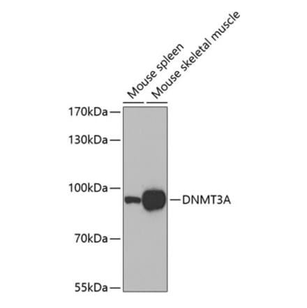 Western Blot - Anti-Dnmt3a Antibody (A14385) - Antibodies.com