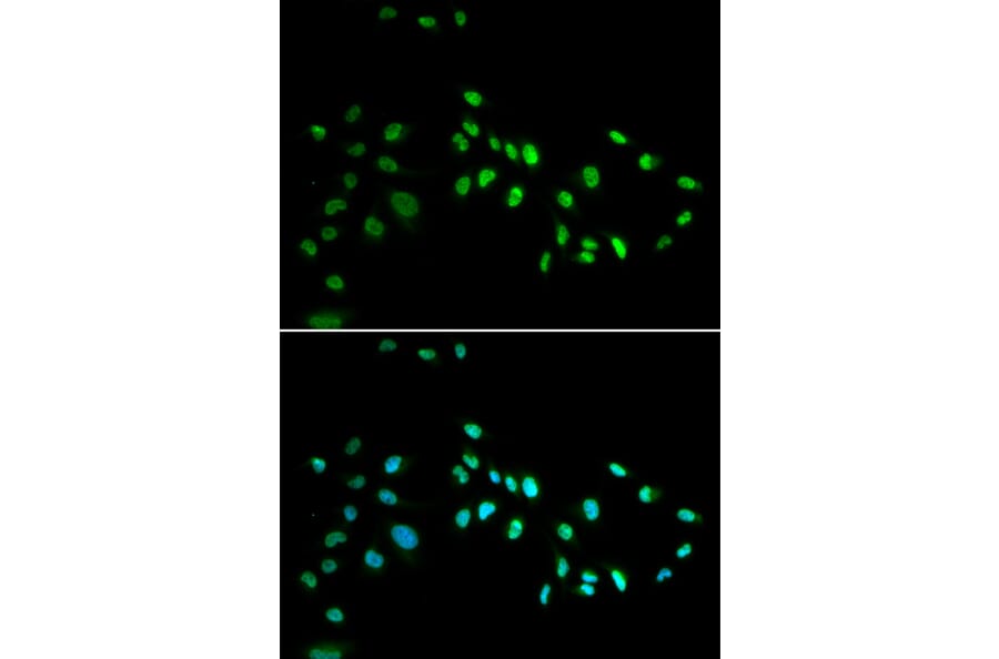 Immunofluorescence - Anti-Dnmt3a Antibody (A14385) - Antibodies.com