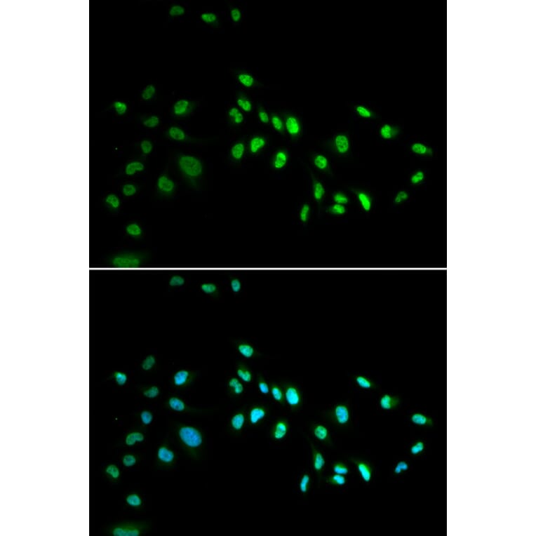Immunofluorescence - Anti-Dnmt3a Antibody (A14385) - Antibodies.com
