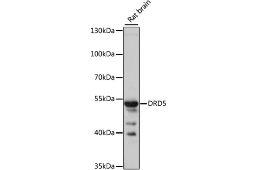 Western Blot - Anti-DRD5 Antibody (A3170) - Antibodies.com